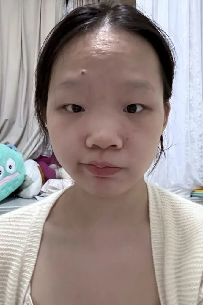 Ảnh gái xấu hai mắt không đều nhau